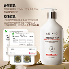 Runhuang Selenium Disulfide Anti-Dandruff Shampoo: Oil-Control, Volumizing Formula That Smooths Frizzy Hair, Relieves Itchiness, and Eliminates Dandruff