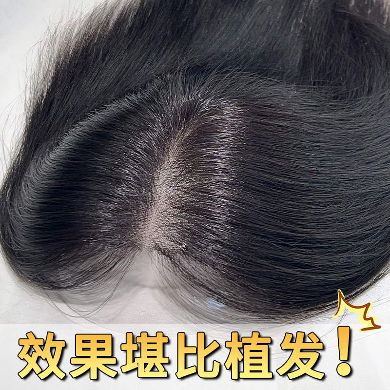 【Simulated Scalp】Cloud Net Eight-Shaped Bangs Wig for Women, Top Hairpiece for Increased Volume, Fluffy Real Hair Fake Bangs 【Simulated Scalp】Cloud Net Eight-Shaped Bangs Wig for Women, Top Hairpiece for Increased Volume, Fluffy Real Hair Fake Bangs