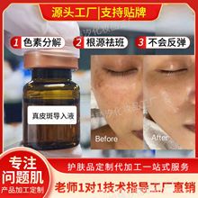 ƤߌܰȡҺȥҺɫطֽҺxҺTĨSְ߾A