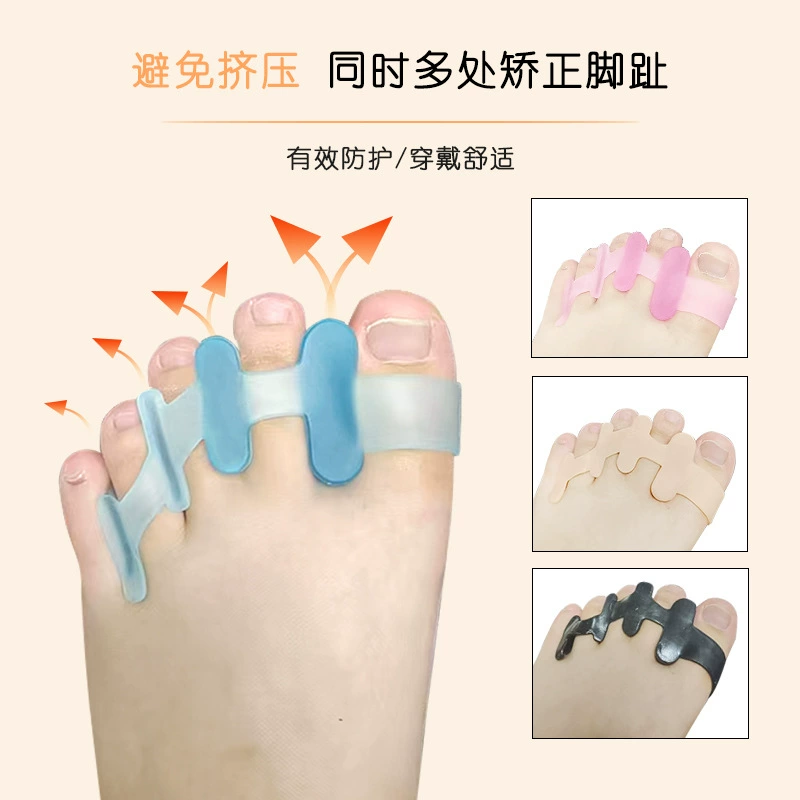 Производственный заказной сепаратор hallux valgus коррекции день и ночь с перекрывающимися пальцами SEBS мост типа разделителя пальцев