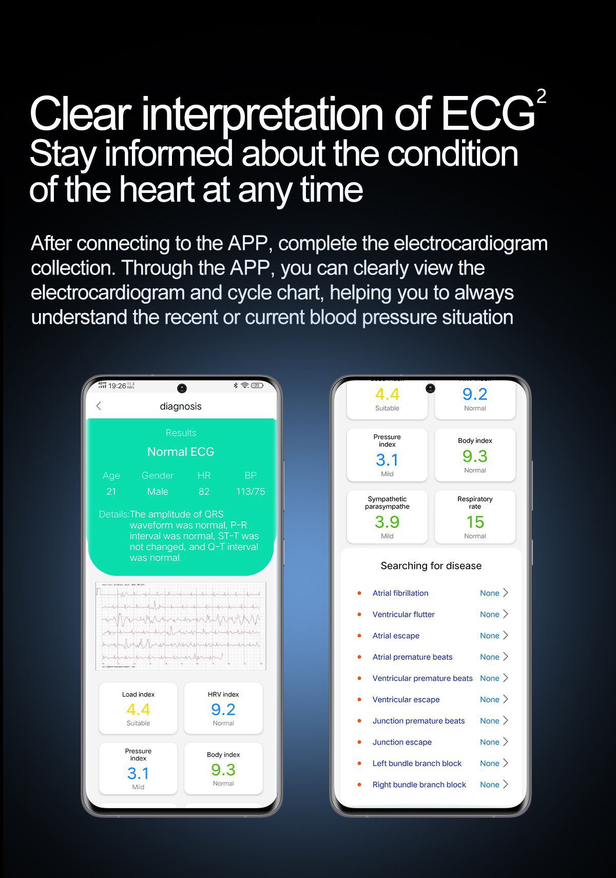 The 2025 new S25 smartwatch, air pump, blood pressure, heart rate, blood oxygen, blood sugar, uric acid, body fat, Bluetooth call undefined