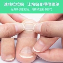 便捷速粘正甲贴片套装嵌甲贴速粘条矫正器正甲丝正甲扣正甲贴厂