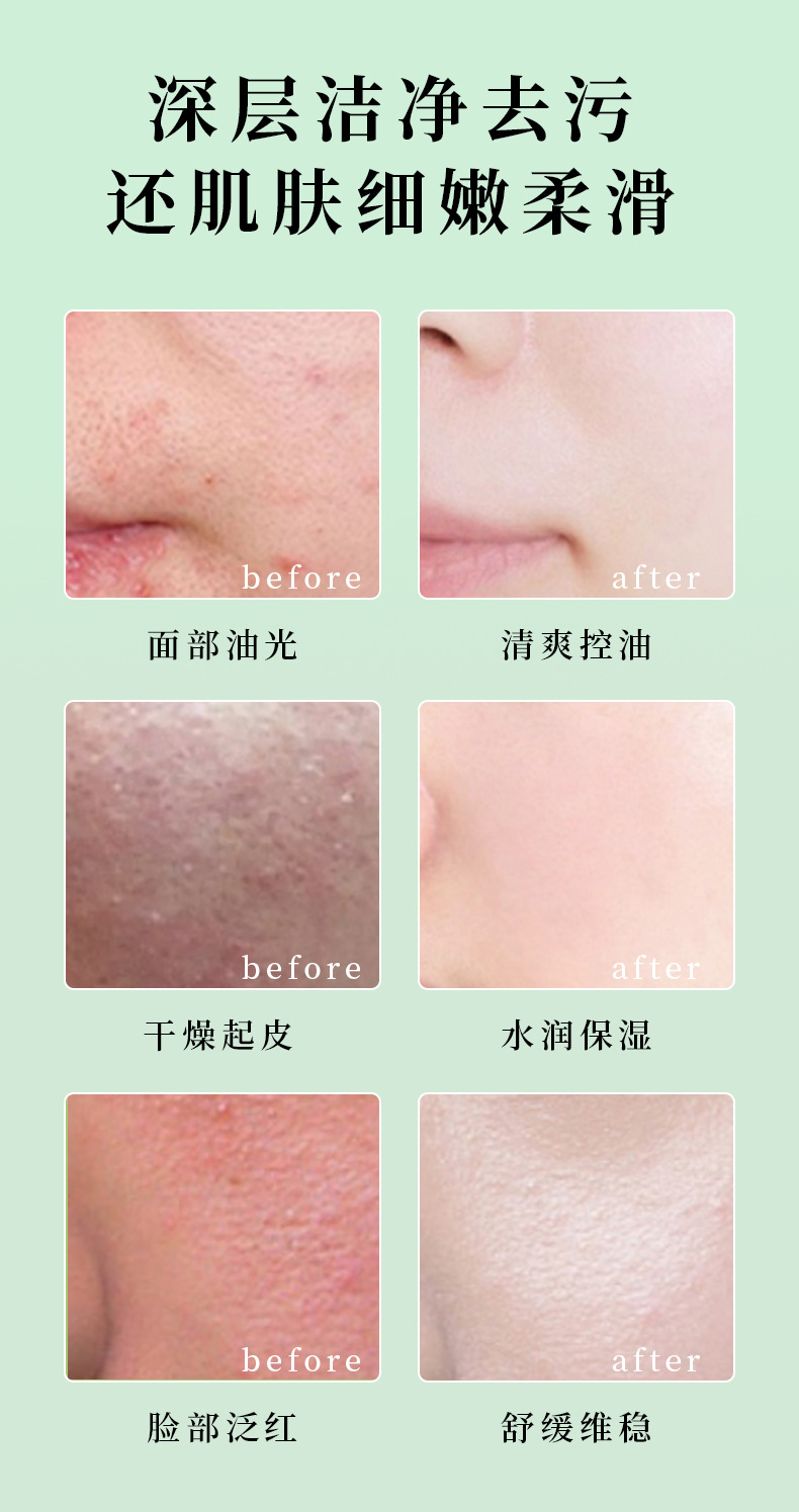Hanjilian's small bubble Soothing aerobic Facial Cleanser, based on acid, foams and cleanses the face with a refreshing and oil-control effect, providing a gentle cleansing experience undefined