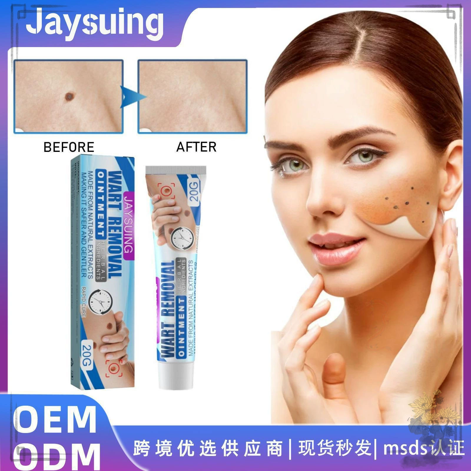 Jaysuing Бородавка крем для восстановления филодермальных бородавок лица и шеи подмышки Мясные зерна для наружного применения для ухода за кожей тела Крем