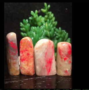 ����ܛ���uѪʯС����С��ӡ���S������Ƭ��ӡ���r�G�c0.8-1.5CM