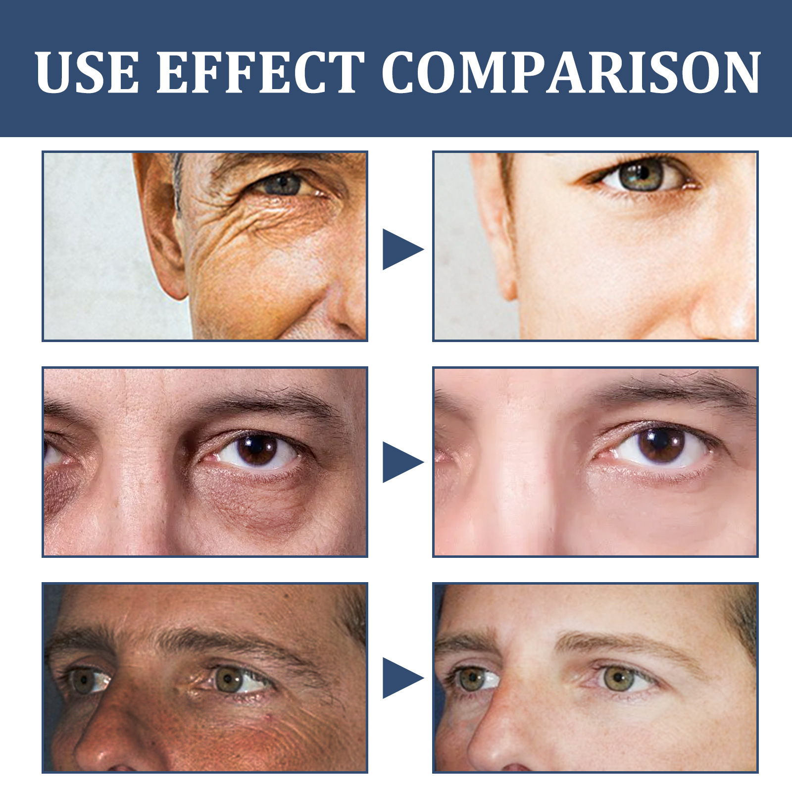 Men's Facial Moisturizer Cream for Soft and Supple Skin, Reduce Fine Lines and Dark Circles - Facial Care Cream_voghion.com
