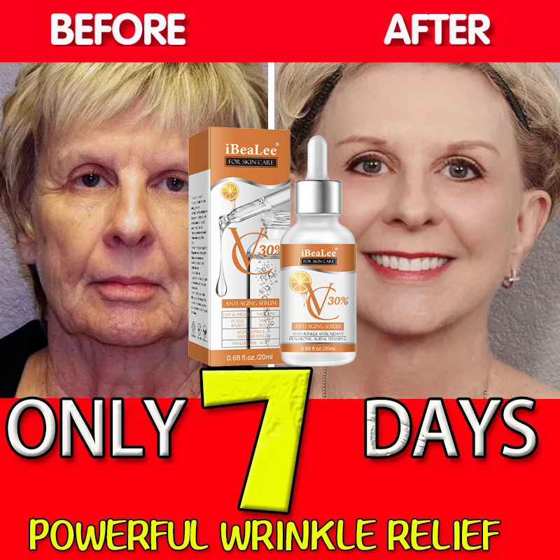 C IBeaLee Vitamin Facial Lighten fine lines remove acne prints, brighten tone, moisturize and tighten skin 2023_voghion.com