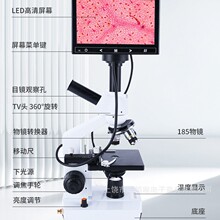 一滴血检测仪血液细胞精子水产养殖便携式显微镜皮肤螨虫检测仪