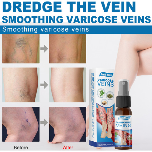 South Moon Vein Massage Varicose Vein Spray Smoothes Blood Vein Bulges Smoothes Earthworm Legs Leg Massage