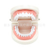 Dental teaching model doctor-patient communication model comprehensive case model removable dental model implant restoration model