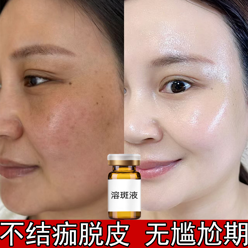 Üz üçün ləkə və piqment açan serum-essensiya