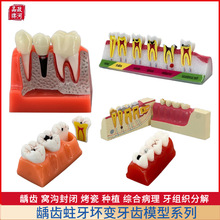 ���X��ǻ��׃ģ���x�X����4���x�X�ֽ����X�lչ��׃ �������Xģ��
