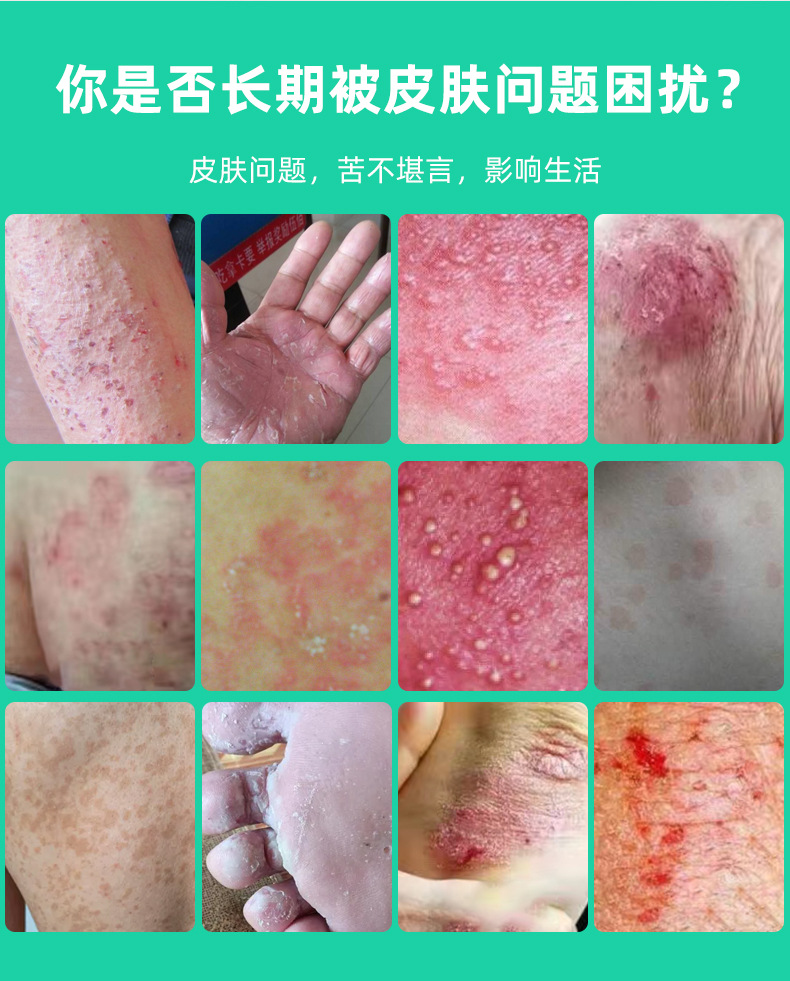 Fu Yang Ling Herbal Skin Ointment 20g External Topical Balm for Legs quality and texture