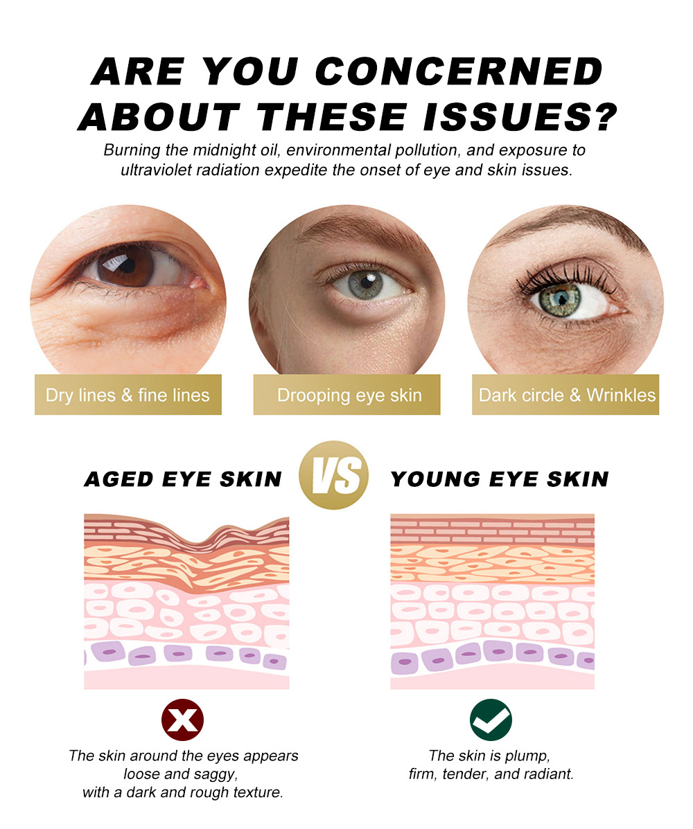YOUNG VISION Retinol Eye Cream Bar Application Scenario