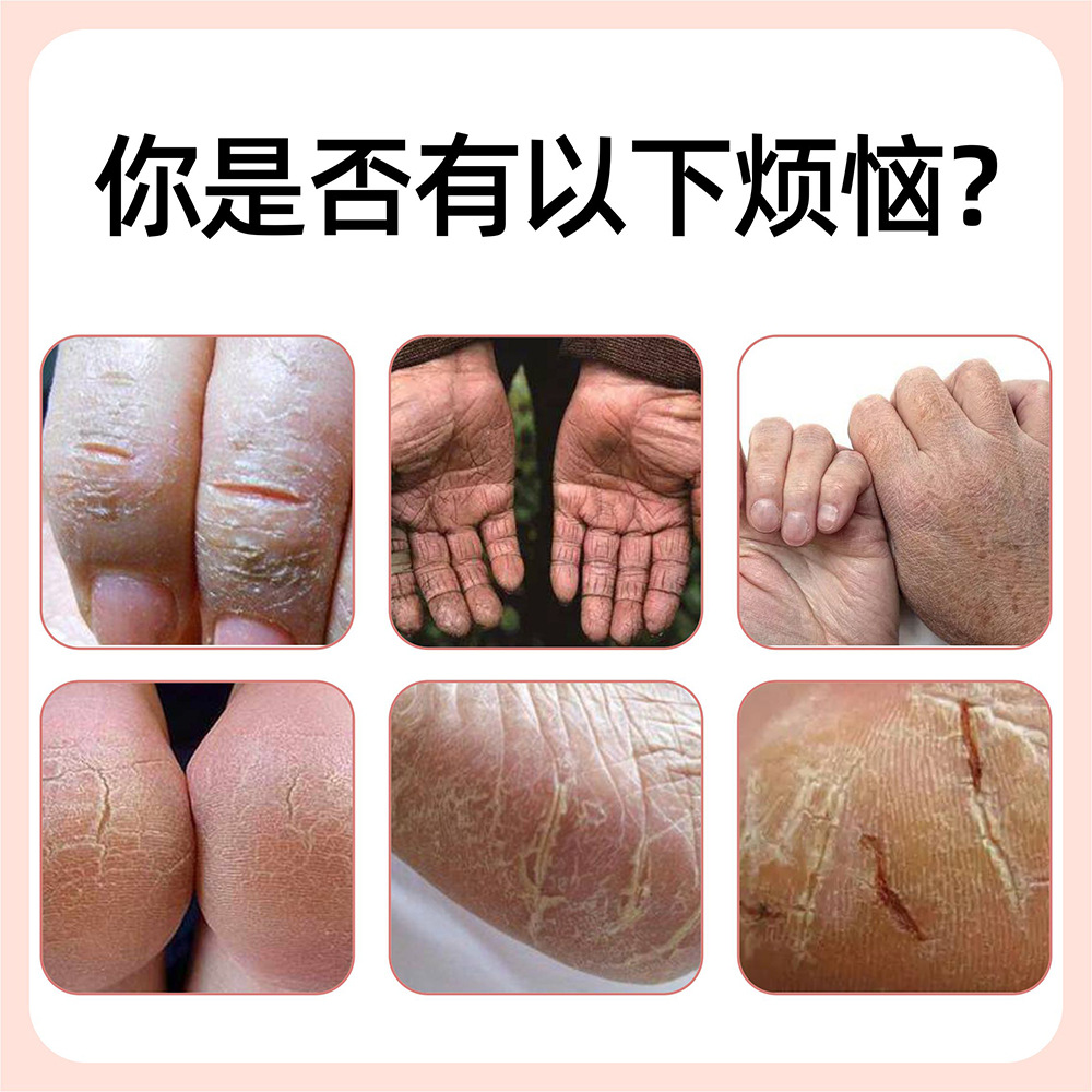 皸裂膏皴裂防凍 馬油手足霜冬季防乾裂膏防脫皮霜護手護足霜滋潤
