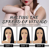 SUHU Крем, лечебная травяная мазь, Amazon, наружное применение, оптовые продажи