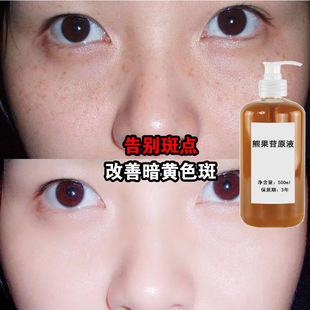 �ܹ��������ɫҺȥ��ɫ���S�ְ�ȸ����Ƥ�����۰����ԭҺ