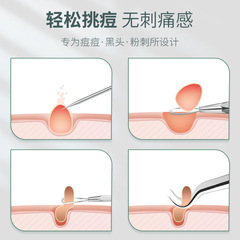 Wholesale stainless steel blackhead needle set, blackhead tweezers, cell tweezers, acne needle 4-piece set, beauty tools