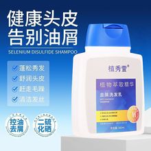 通用理发馆专用二硫硒洗剂洗发水去屑止痒头皮控油洗发露护发精油