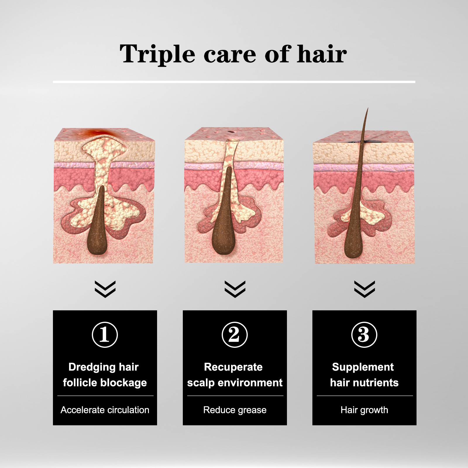 Promuove la crescita dei capelli per capelli più spessi e più sani - Siero per la crescita dei capelli con massaggio del cuoio capelluto_voghion.com