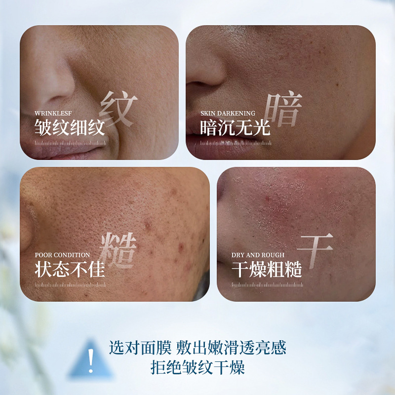 澳楠璨金焕采多肽抗皱精华面膜抗皱保湿温和滋润嫩肤提亮均匀肤色|undefined