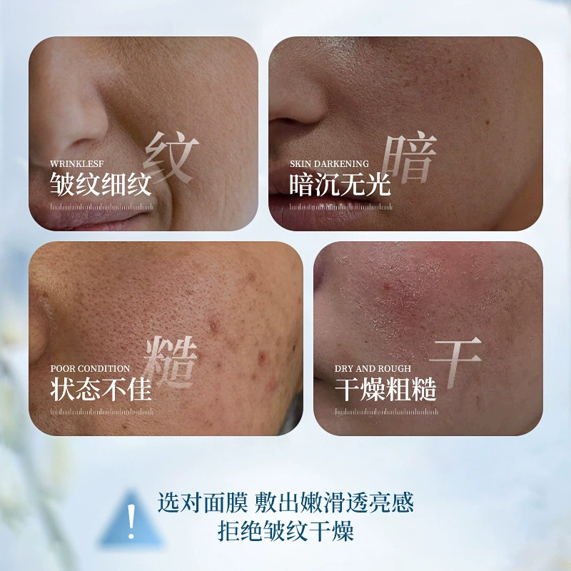 Essence 澳楠, увлажняющая мягкая питательная осветляющая маска для лица, против морщин, омоложение кожи, выравнивает тон кожи