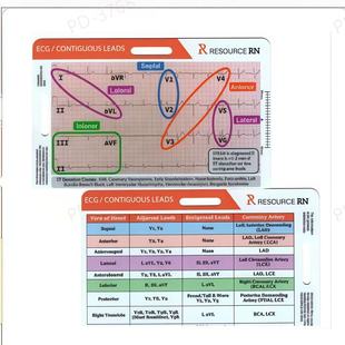 �羳Ʒ���Ҝy���߿ڴ�����늈D7����ECG/EKG Rhythm Pocket Card