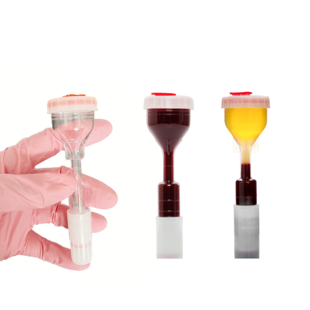 Yecell prp tube7