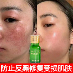 美容院修復因子 フェイシャルリペア液 クリーム イボ・シミ・火傷後の皮膚修復因子 成長ペプチド