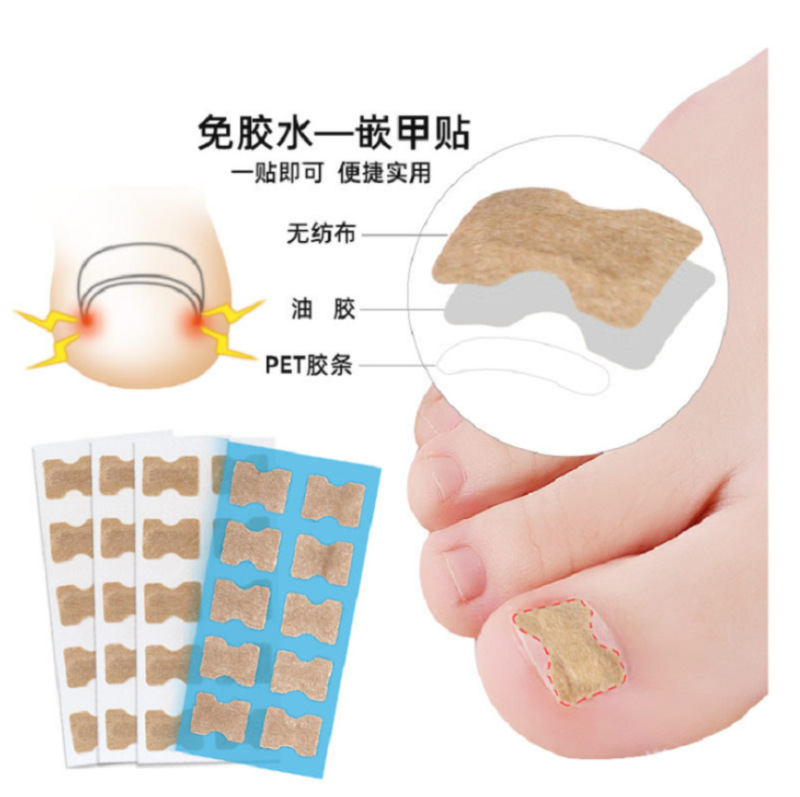 Glue-Free Nail Patch, Nail Groove Ingrown Nail Corrector, Toenail Patch, Manicure Factory Supply