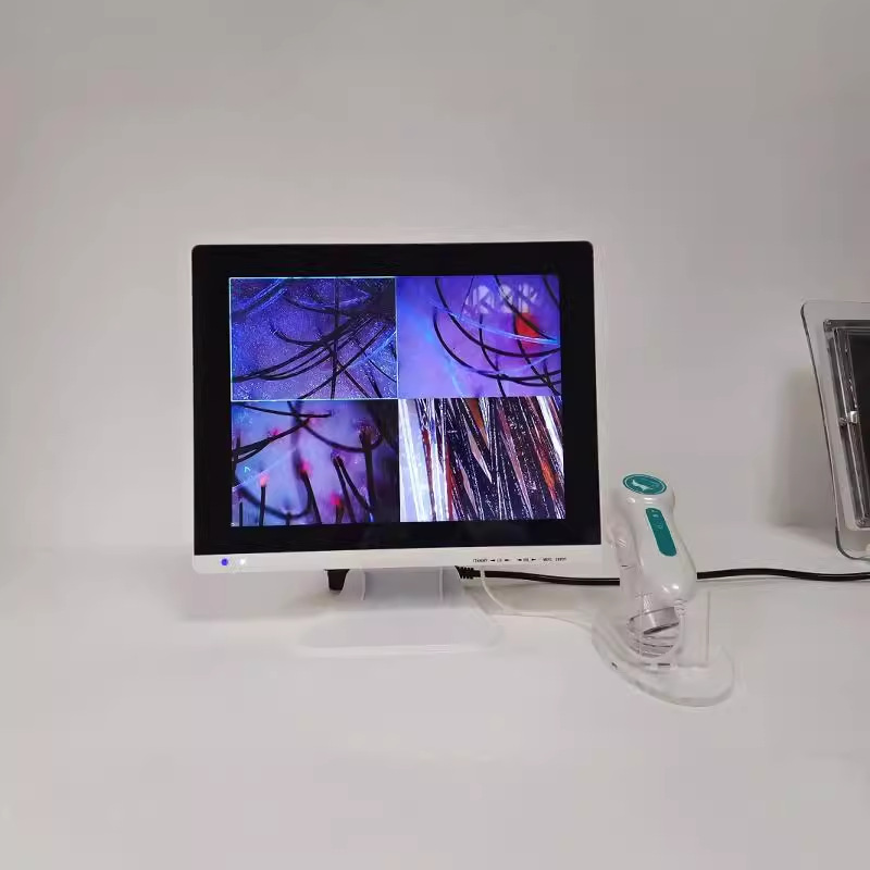 2024 두피 탐지기 모낭 HD 다기능 테스트 기계 프로브 이발소 미용실