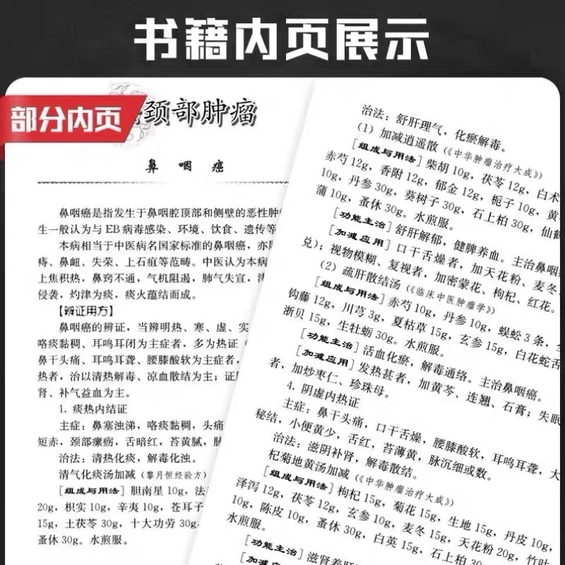 Tumor Specialty Prescriptions Specialized Disease Specialty Prescriptions Series Editor-In-Chief Pan Minqiu and Li Yueheng 33 Modern
