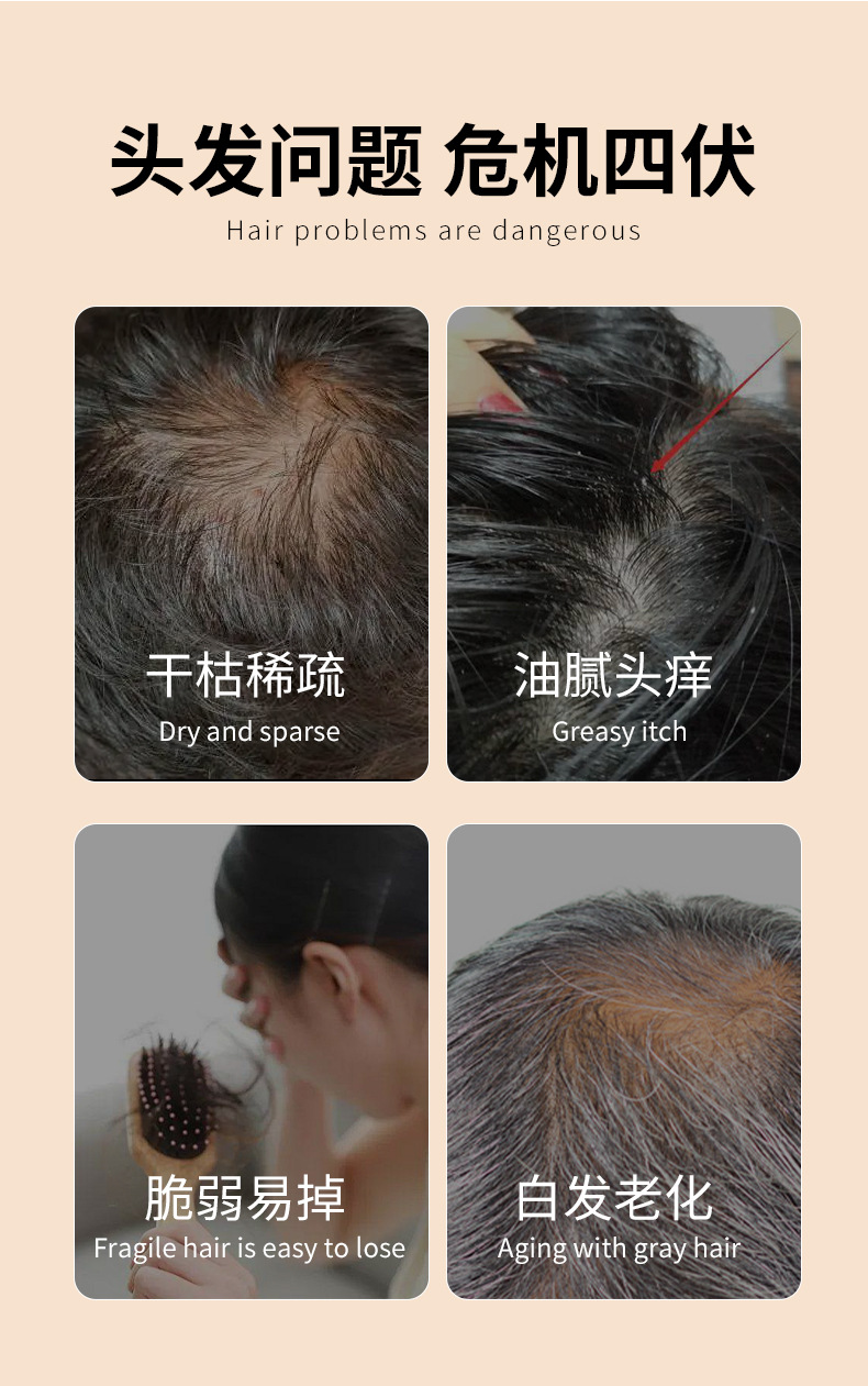Handmade He Shou Wu Hair Soap Bar with Oriental Arborvitae for Refreshing Oil Control 100g specifications
