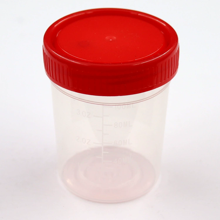 Винтовая чашка для мочи, чашка для табурета, чашка для отбора проб, мерная чашка, чашка мокроты, 40 мл, 60 мл, 120 мл, различные характеристики