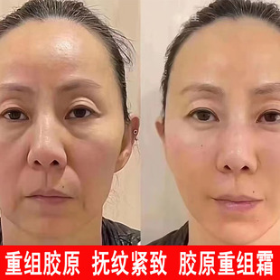Collagen Filling Cream Anti-Wrinkle Firming Cream Repair Moisturizing Anti-Wrinkle Beauty Rejuvenation Cream Collagen Restructure Cream
