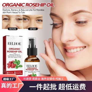 EELHOE Rose Hip Oil Facial Essence Moisturizing Fade Wrinkles Fine Pores Anti-aging Essence