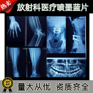 ��ī�{ɫ�t���zƬ�{����ʽ����ƴ�ӡ�zƬ���ƹ���X��Ƭ DR CR CT