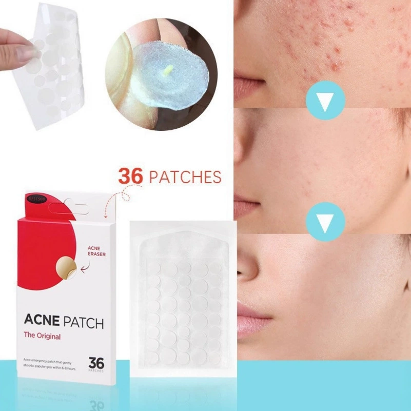 Внешняя торговля трансграничные прыщи наклейки ACNE PATCH Полный английский портативный наклейка прыщей гидроколлоидное тело покрывает прыщи