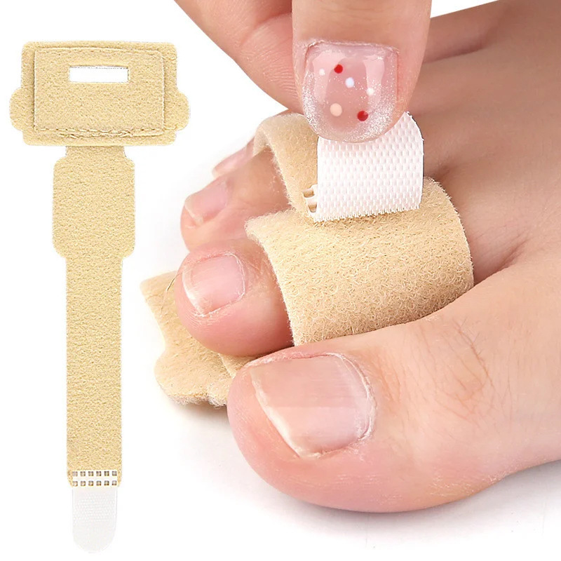 Toe Brace with Aluminum Plate for Protection and Support, Toe Brace Plate with Velcro Fastening, Custom Protective Gear