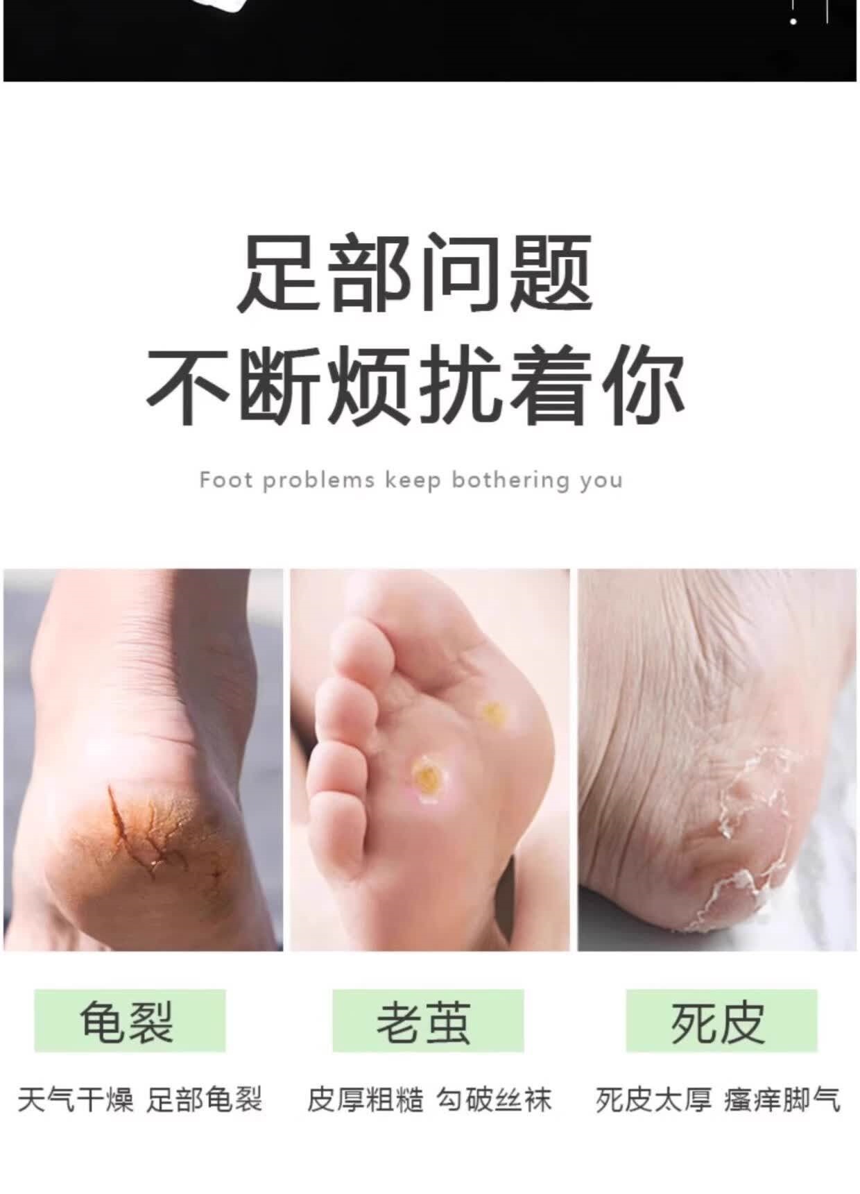 Double-Sided Stainless Steel Foot File Callus Remover Pedicure Tool 5 Pack key features