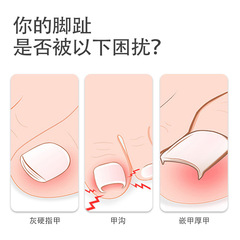 New stainless steel nail clippers, dead skin callus removal, pedicure knife, nail groove, olecranon pliers, manicure set, manicure tools