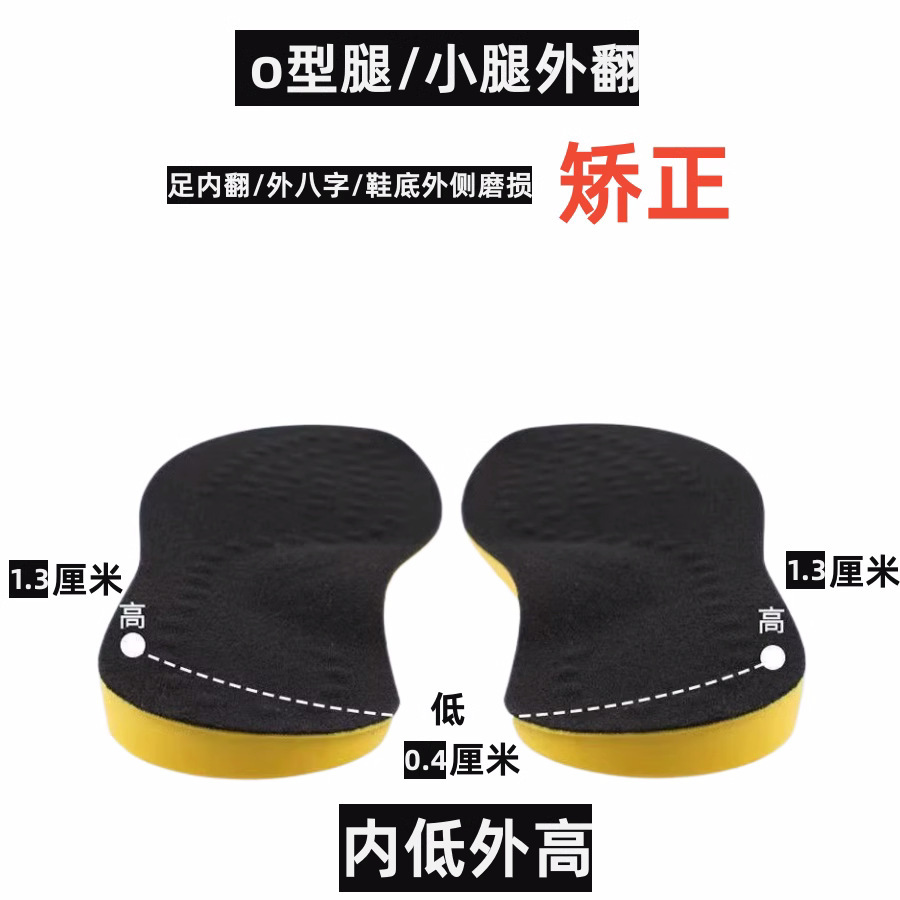 Adultos O-pierna corrección plantilla pie Varus pie plano pantorrilla valgus pierna corrector único desgaste exterior