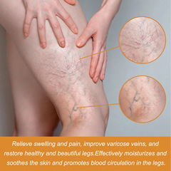 South Moon Vein Repair Series - Relieves Pain, Swelling, Varicose Veins, and Prominent Blue Veins