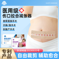 帝王切開甲状腺手術用医療用テンションリリーバー、縫合糸不要のジッパー式皮膚瘢痕リリーバー
