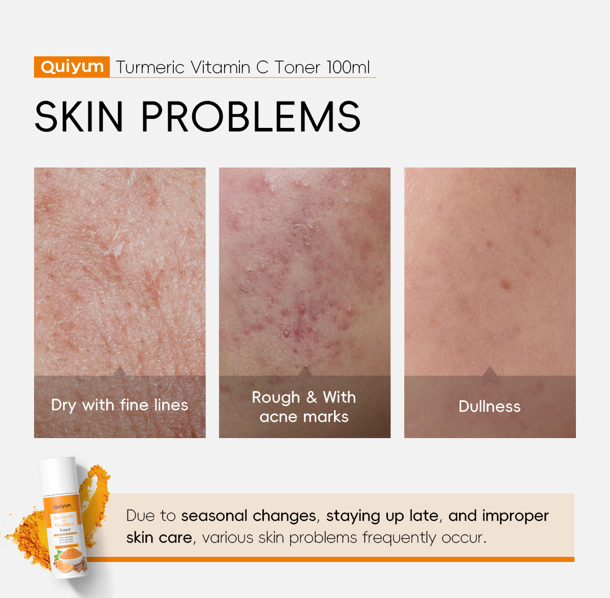 Cross-border new product QUIYUM Turmeric Vitamin c Toner 100ml for hydrating and moisturizing the face is available for wholesale from the manufacturer undefined