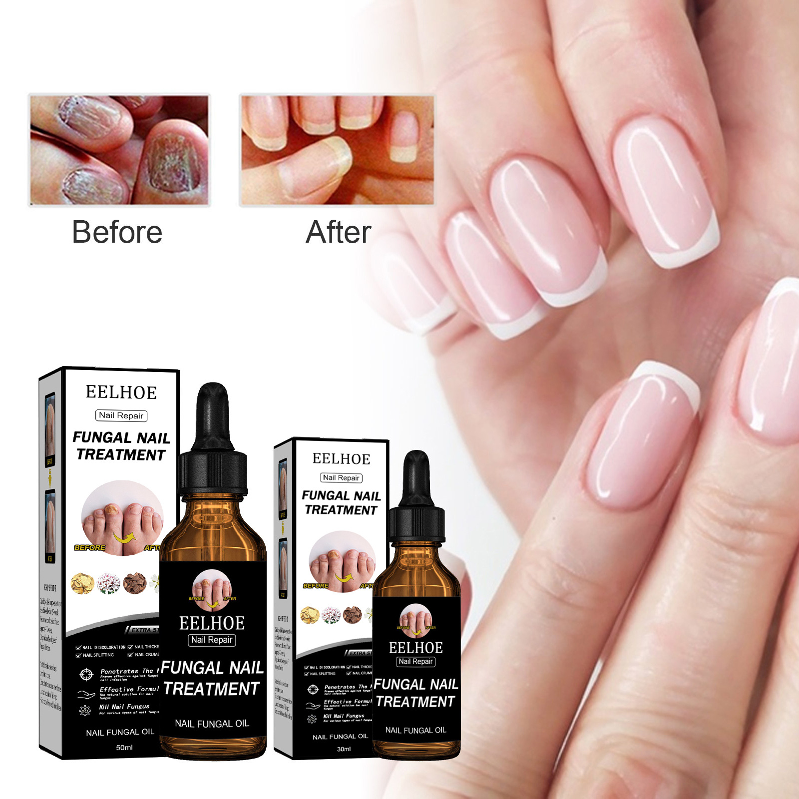 EELHOE Nail Repair Liquid - Thickening, Shining, Gray Nail Removal, Dead Skin Repair, Nourishing and Moisturizing Nail Beauty and Nutrition Care Liquid