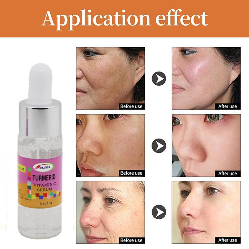 Siero alla vitamina c con olio di curcuma idratante viso_voghion.com