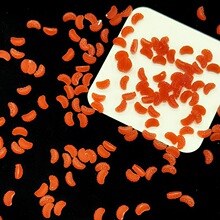 ���������Ӱ��֬���׷���ʳ�����~΢�s������ʷ�Rķ�����z���