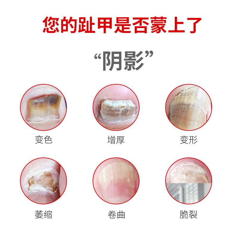 ハーブレインデューグレイネイルメーカーの手足用グレイネイルクリーナー、新しく輝く爪、厚く柔らかい爪、ハーブフットリペアソリューション|undefined