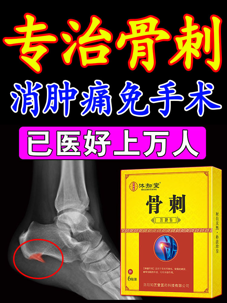 Spur Plaster A spirit Lumbar Bone knee Proliferate Heel Degenerative Plaster Lasting